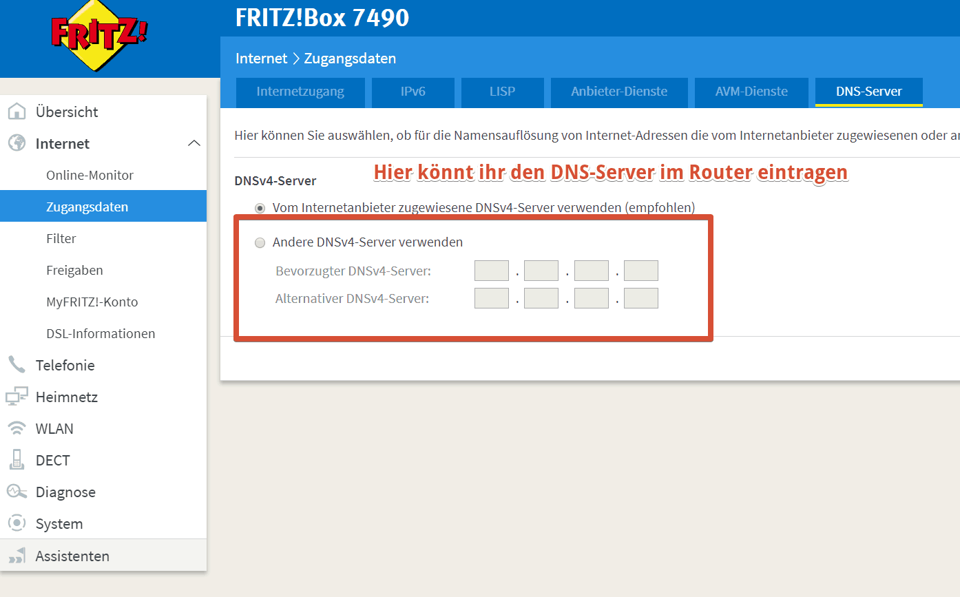 DNS-Server im Router aendern
